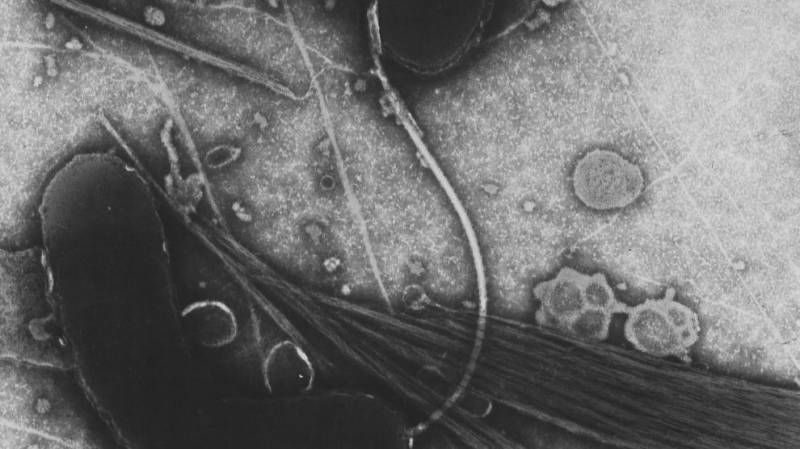 <span style='color:#780948'>ARCHIVED</span> - The first case of cholera bred in Spain since 1979 detected on a farm in Toledo