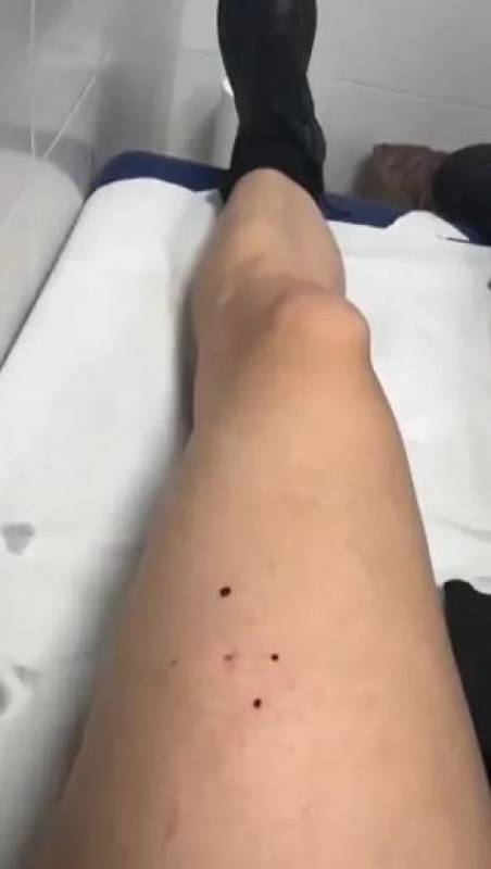 VIDEO: Singer bitten by bat live on stage at Sevilla AC/DC concert